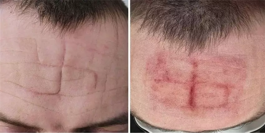 Тавро злочинцям на лобі
